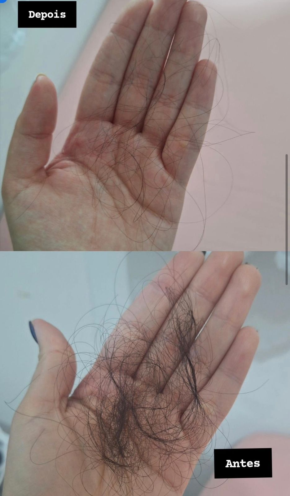 Comparativo de queda capilar controlada